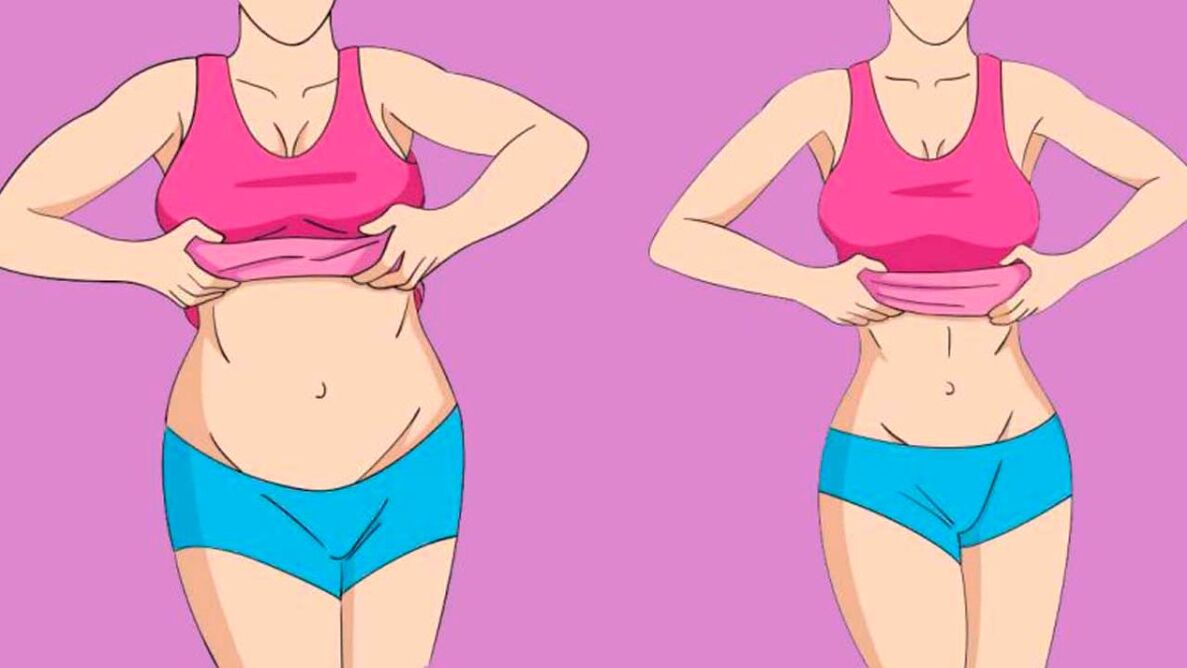 burta șorț înainte și după pierderea în greutate