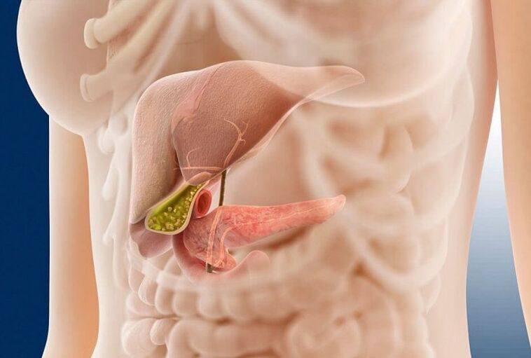 Ce este pancreatita
